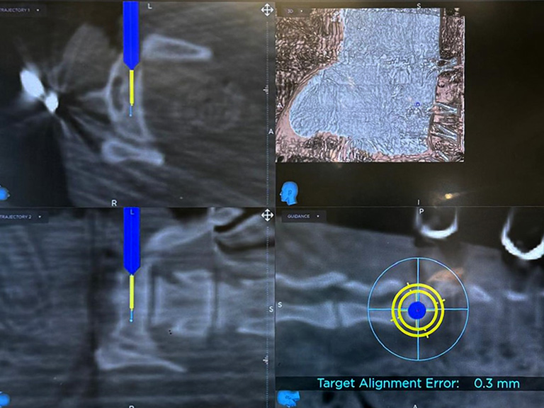 © Pia Düver, Photograph taken during surgery (patient of the study)